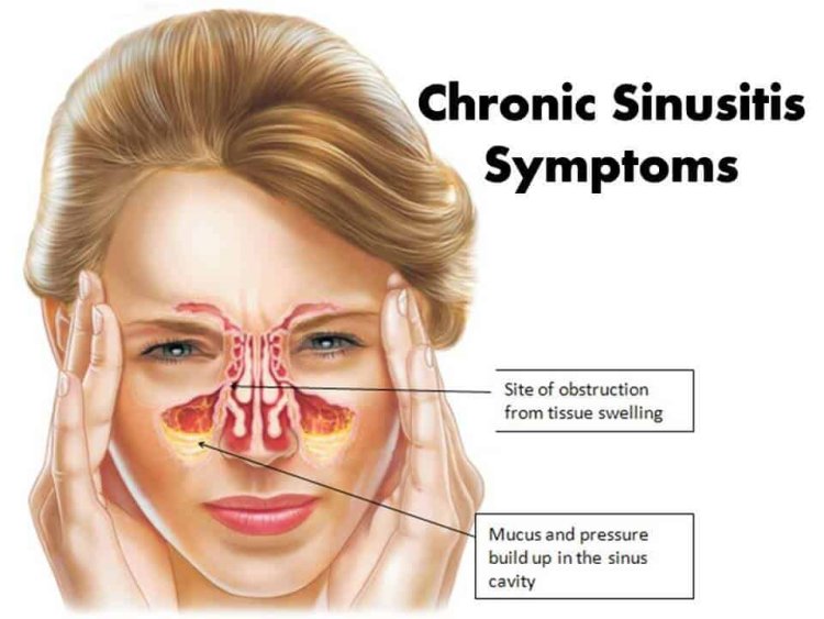 understanding-and-handling-sinus-problems-the-relationship-between