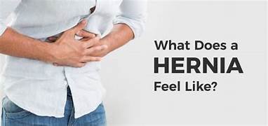 Living with a Hernia: Strategies for Coping and Adjusting Your Lifestyle